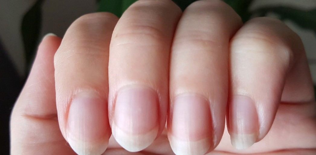 Ребристые ногти на руках причины у женщин и лечение фото