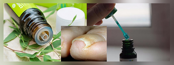 Зелёнка как средство лечения грибка ногтей
