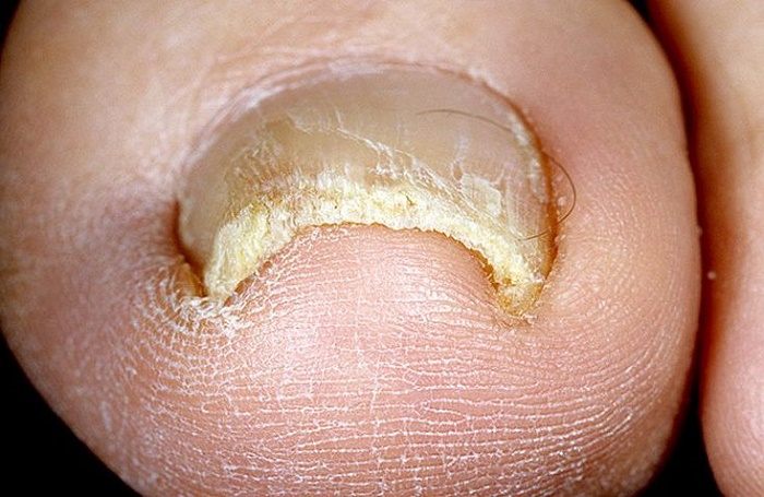 Польза хозяйственного мыла для ногтей thumbnail